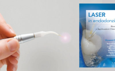 Basi e vertici del Laser in endodonzia in un nuovo volume di Giovanni Olivi