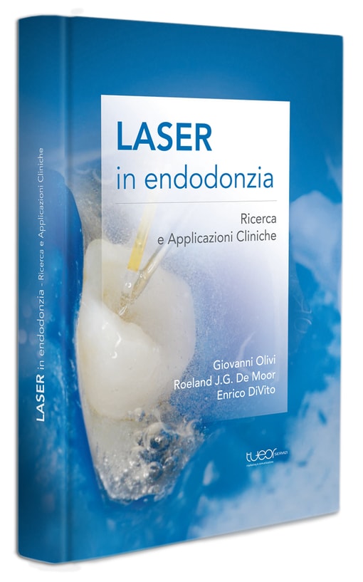 laser in endodonzia