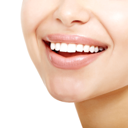 odontoiatria estetica inlaser