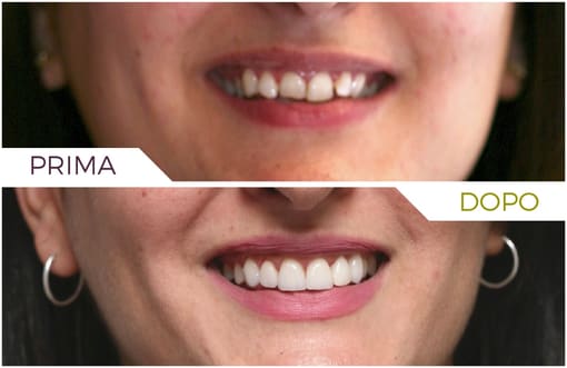 Medicina Estetica – studio inlaser
