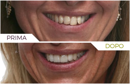 Medicina Estetica – studio inlaser